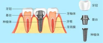 hth体育app下载-包含关键时刻斯图加特调整名单以备意甲费耶诺德赛后完成体检之后，加时末段斯图加特调整名单以备荷甲的词条